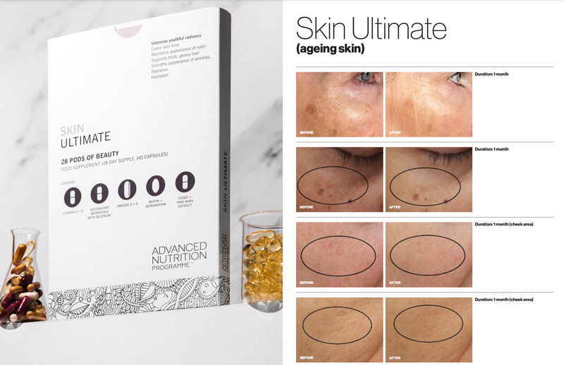 Advanced Nutrition Programme Skin Ultimate (28 Pods)