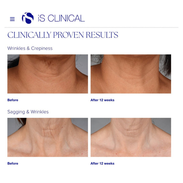 isClinical NeckPerfect Complex 50g