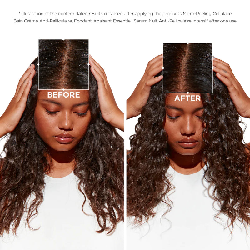 Kérastase Symbiose Trio Bundle - Anti-Dandruff Care For Dry Scalp